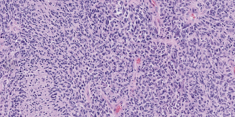 Tissue Bank boost for brain cancer researchers