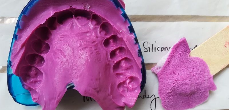 Silicone impressions of human palate and tongue. 