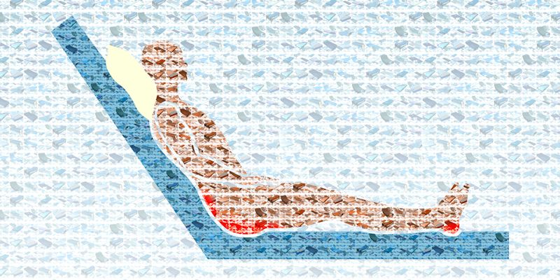 Illustration of pressure points from a hospital mattress