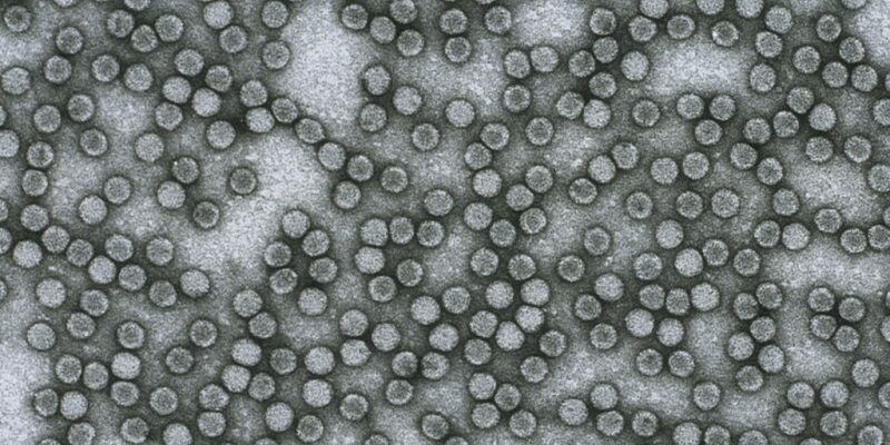 The image shows an electron microscope picture of the polio virus