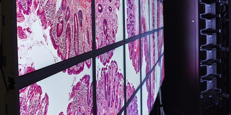 Digital pathology