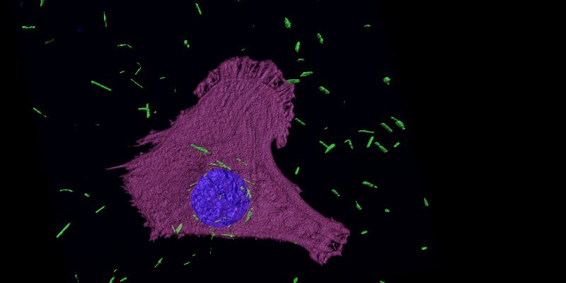 The image shows an elecron micrscope image of green coloured nanotubes in a mesothelioma cell