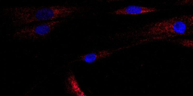 Microscopy image showing human muscle cells with nuclei in blue, and stress caused by the ceramide stress signals shown in red