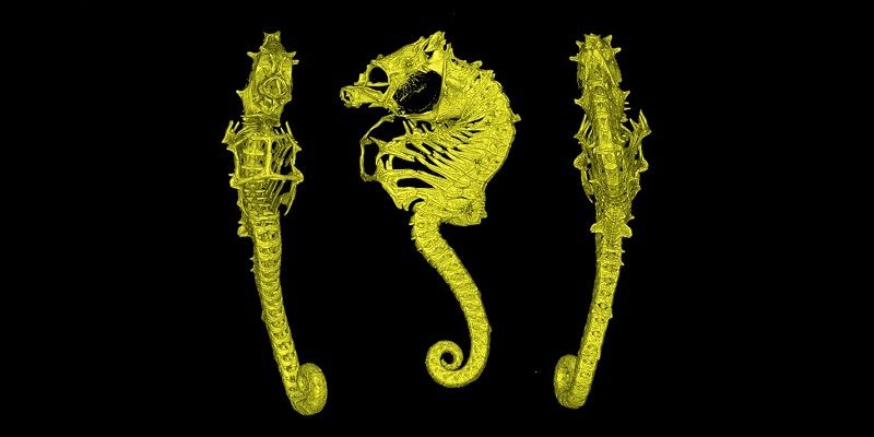 CT scan of Hippocampus nalu 