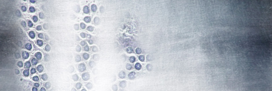 Silver with human cells