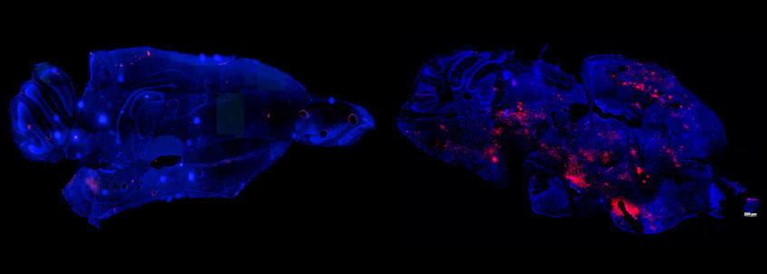 Side by side images of mice brains show healthy tissue in blue, with one of them showing pink colouration due to a deadly virus