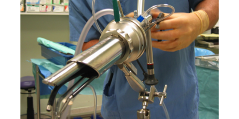 Metallic equipment is held by a surgeon, used for the local keyhole surgery