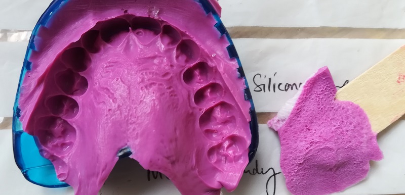 Silicone impressions of human palate and tongue. 