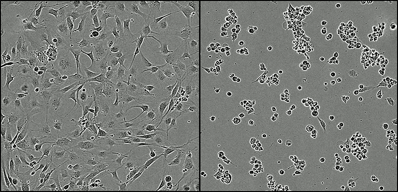 Tumour cells being treated with KHS101