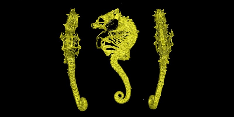 CT scan of Hippocampus nalu 