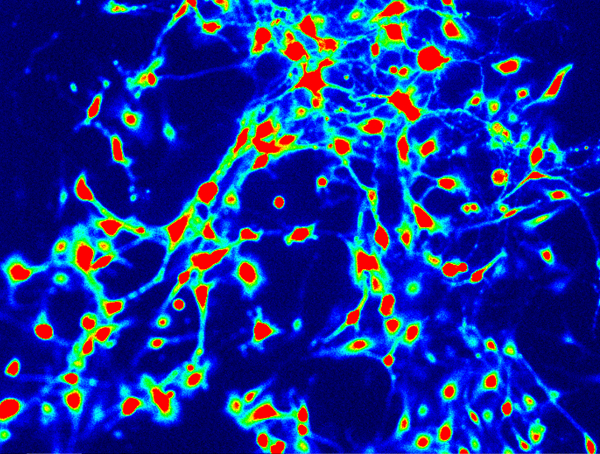 ‘Pain paradox’ discovery provides route to new drugs