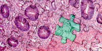 Bright pink digital slide mixed with IT hardware