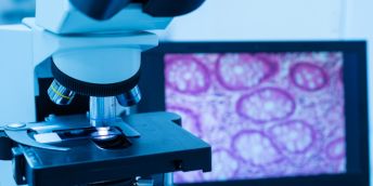 Microscope with human tissue slide on screen in background