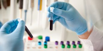 A pair of hands in blue gloves holding blood samples in a lab