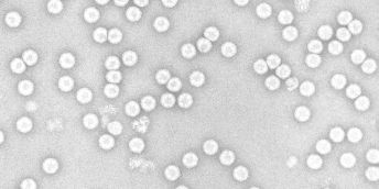 A microscopic view of poliovirus, which looks like clusters of white dots on a grey background