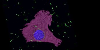 The image shows an elecron micrscope image of green coloured nanotubes in a mesothelioma cell