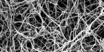 A network of criss-crossing fibrin fibres as seen with an electron microscope.
