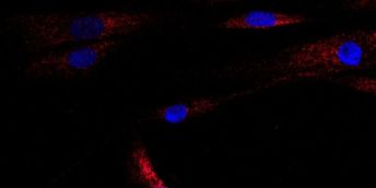Microscopy image showing human muscle cells with nuclei in blue, and stress caused by the ceramide stress signals shown in red