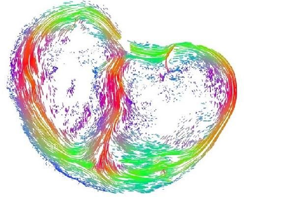 Picture shows the fetal heart 128 days into pregnancy