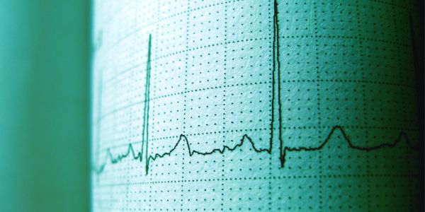 Heartbeat spikes measured on an electrocardiogram