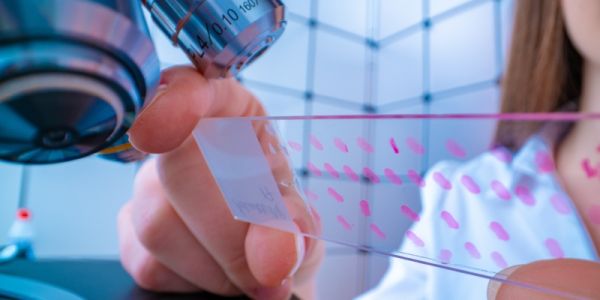 A researcher looking at a slide with cell samples on it