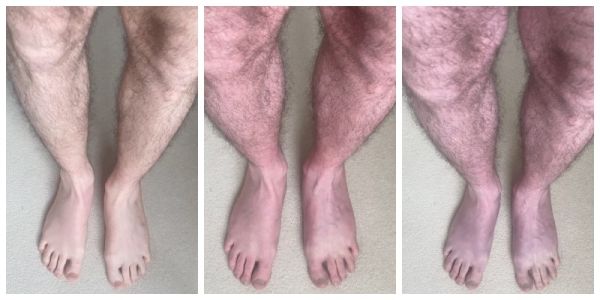 Photos showing three pairs of legs of different skin colours