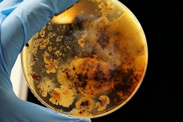 A petri dish being held up by a gloved hand