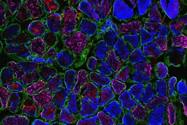 A cross-sectional image of muscle showing how L-BAIBA alters muscle fibres to make them more resistant to fatigue.
