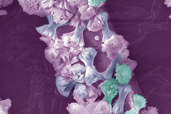 A microscopic image of a mechanically-activated ion channel, Piezo1