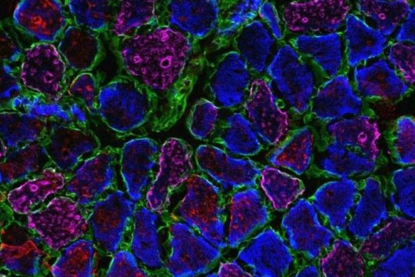 A cross-sectional image of muscle generated in a lab - round shapes of different sizes tightly packed together.