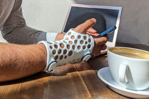 A man wearing a specialised 3D-printed medical cast holding a phone with a coffee in the foreground.