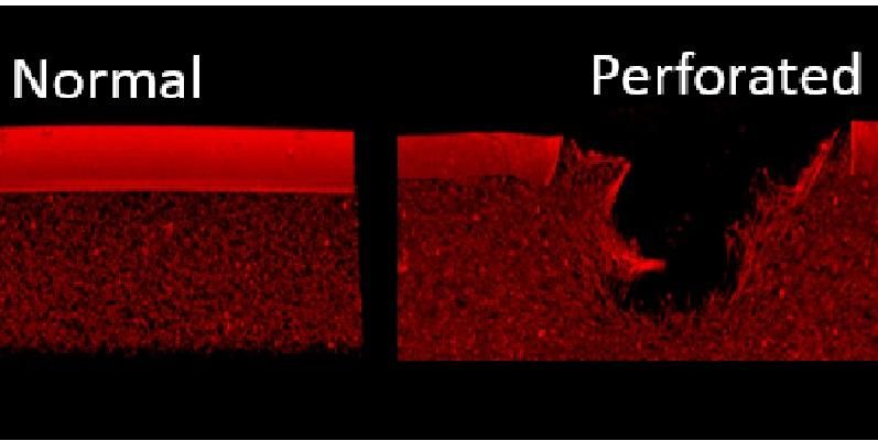 Image shows a perforation in the fibrin bio-film caused by an oil-based substance