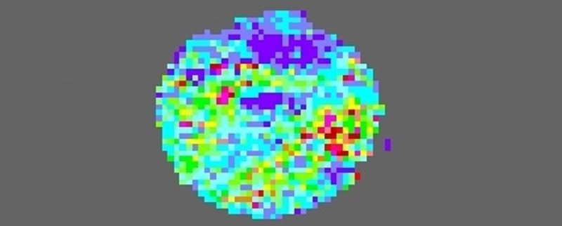 This scan was taken from a mouse that had received M-3, and it shows improved blood flow.