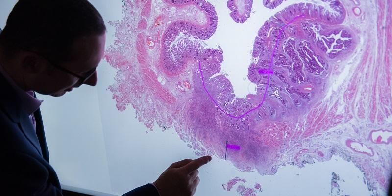 A silhouette of someone examining a large blown- up image of a cross section of bowel tissue, in order to look for signs of abnormal cell behaviour