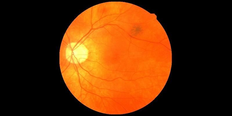 A retinal scan