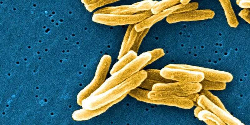 Tuberculosis under microscope