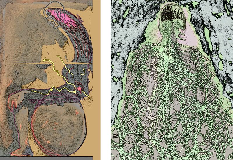 Two pieces of artwork illustrating spinal injuries and interpreting spinal pain.