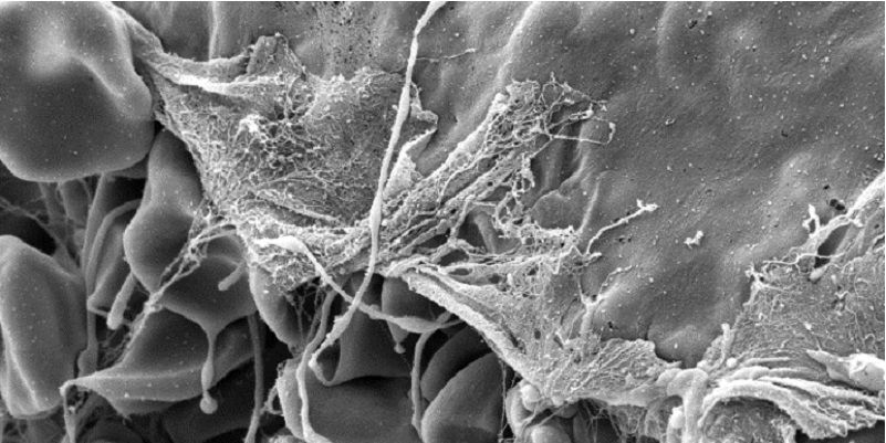 Fibrin fibres transforming from spaghetti like coils into a sheet to cover an open wound