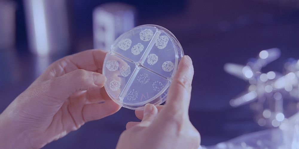 Two hands holding a petri dish containing a mycobacterium tuberculosis drug susceptibility test. Picture free to use via Unsplash.com/CDC