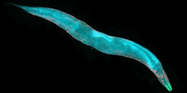 A microscopic nematode worm, which appears bright blue against a black backdrop