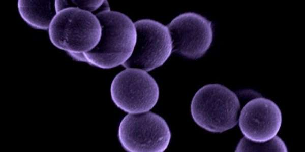 Image shows a pictuire of the MRSA bacteria under an electron miscroscope