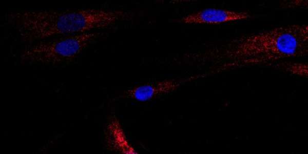 Microscopy image showing human muscle cells with nuclei in blue, and stress caused by the ceramide stress signals shown in red