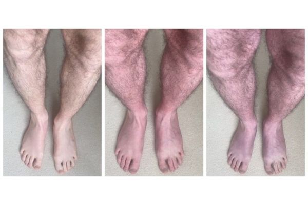 Three images of pairs or legs, getting progressively bluer in colour