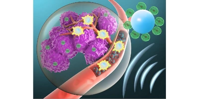 Using targeted microbubbles to administer toxic cancer drugs ...