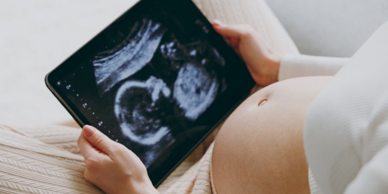 A pregnant stomach and hands holding a screen with an ultrasound image on it