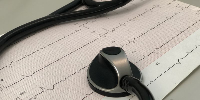 The image shows a print out of a heart trace on a desk. Laid over the top is a stethoscope.