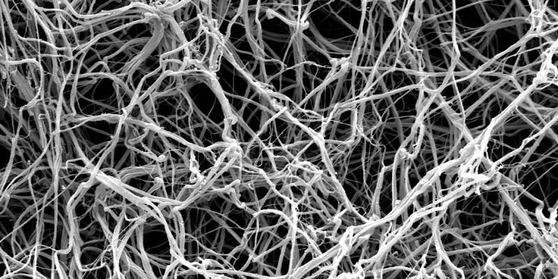 Fibrin fibres as seen with an electron microscope. It shows a network of criss-crossing fibres