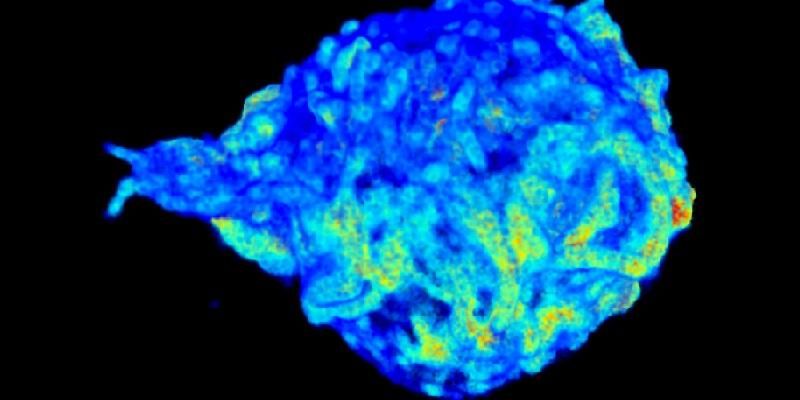 The image shows an electron microscope picture of a cell. It is an oval shape structure with a blue colour.
