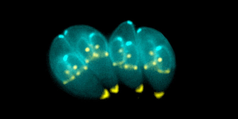 microscopic images of Toxoplasma gondii parasites