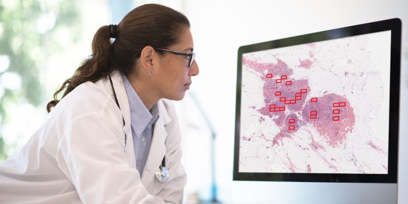 A female doctor inspecting histopathology images of breast cancer tissue using the 4D Q-plasia OncoReader Breast technology